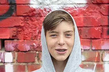 A teenage boy wearing braces